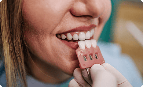 Dental patient undergoing teeth whitening with a shade guide.