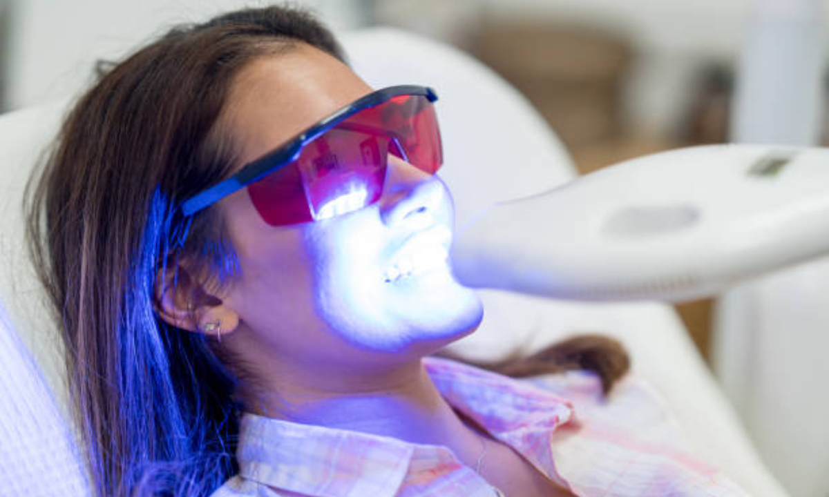 professional teeth whitening