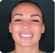 Close-up of a smiling woman with perfect teeth and clear skin.