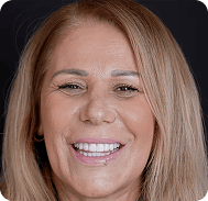 Smiling woman with blonde hair showcasing healthy teeth at Ultimate Blogging Championship.