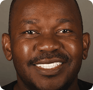 Close-up of a smiling man with a bright, healthy smile.