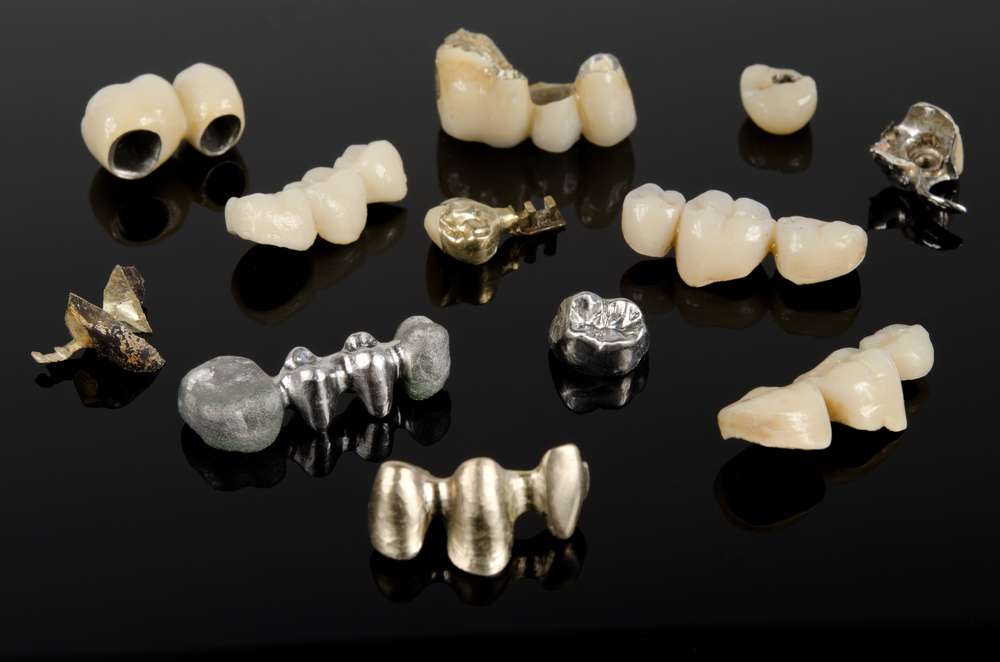 zirconia crown vs metal ceramic